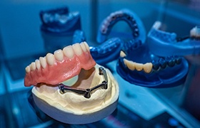 Dentures on a dental model