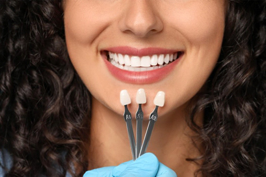 Woman smiling while dentist compares her teeth to several veneers