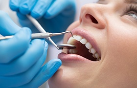 Patient receiving scaling and root planing periodontal therapy