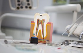 Model of the inside of a healthy tooth before root canal therapy