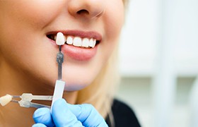 Woman's smile compared to porcelain veneer shade chart