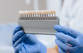 Dentist holding row of veneers in Milton