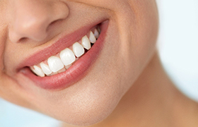 patient smiling after getting teeth whitening in Milton
